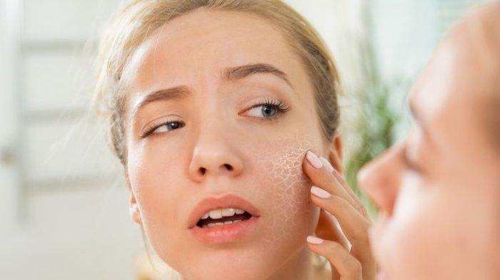 How to Prevent Dry Skin Due to Air Conditioning VUONS