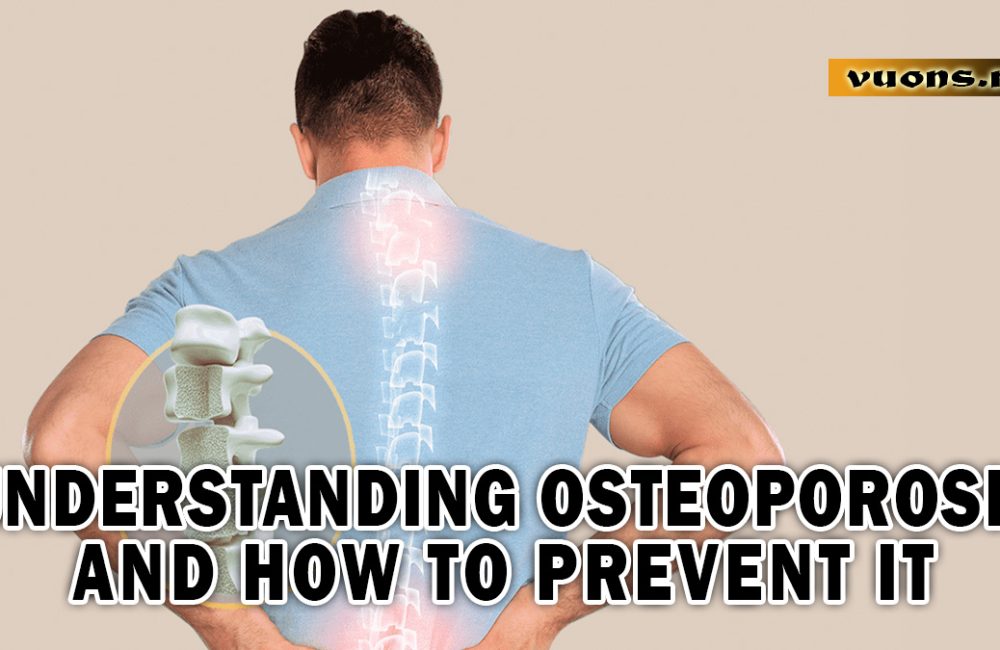 UNDERSTANDING OSTEOPOROSIS AND HOW TO PREVENT IT