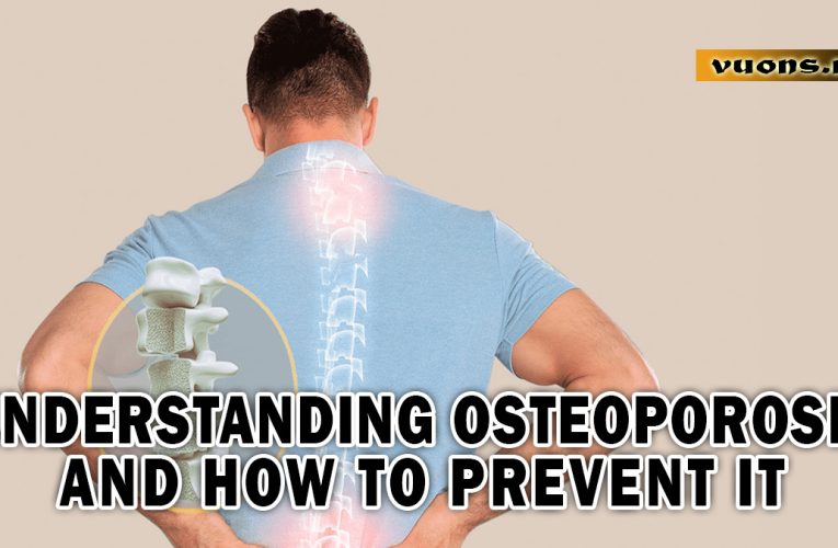 Understanding Osteoporosis and How to Prevent It