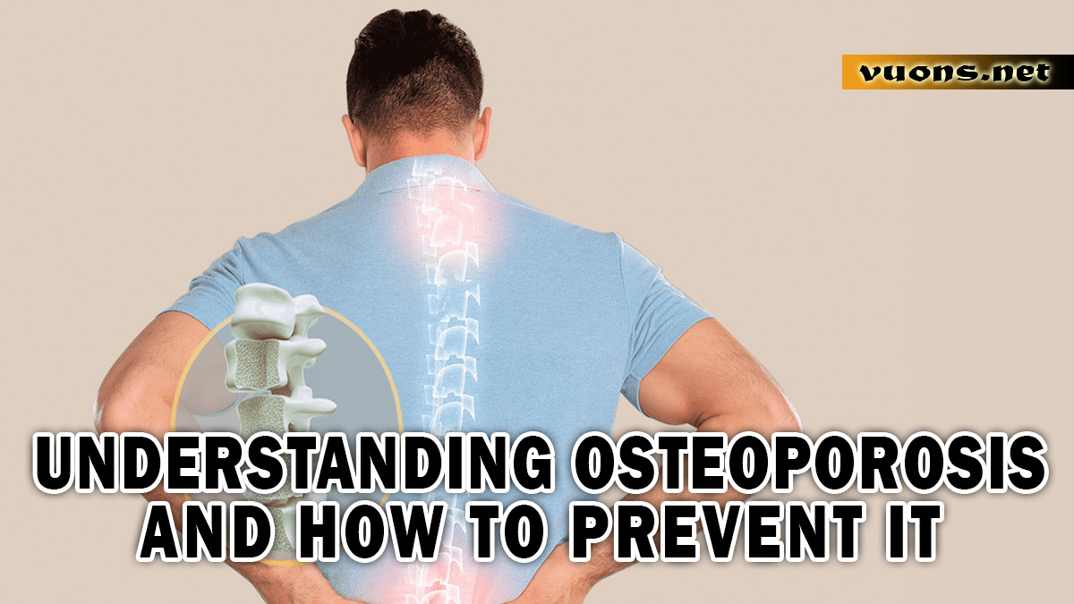 UNDERSTANDING OSTEOPOROSIS AND HOW TO PREVENT IT